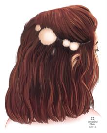 انواع-ریزش-مو-در-خانم-ها-3